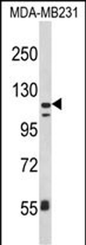 ITGAX Antibody (C-term)