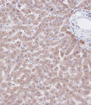 CBS Antibody (Center)