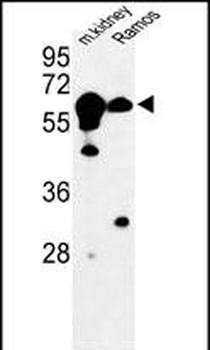 CBS Antibody (N-term)