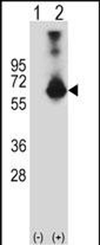CBS Antibody (N-term)