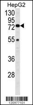 HEXA Antibody (N-term)