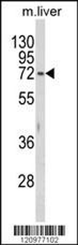 HEXA Antibody (N-term)
