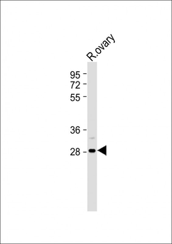 IGFBP4 Antibody (N-term)