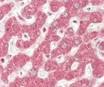 ND5 Antibody (C-term)