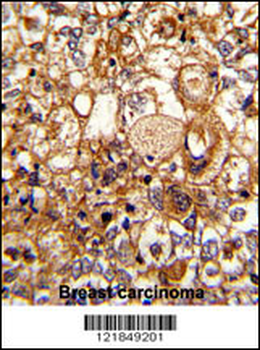 C6 Antibody (N-term)