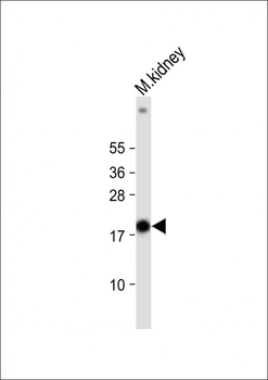 NDUFS4 Antibody (C-term)