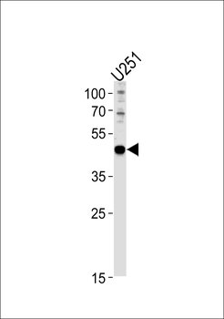 PAX6 Antibody (Center)