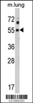 KCNJ2 Antibody (C-term)