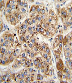 MCCC2 Antibody (Center)