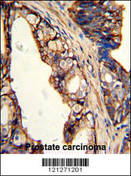 TGM4 Antibody (Center)