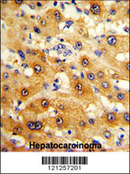 RPS15 Antibody (N-term)