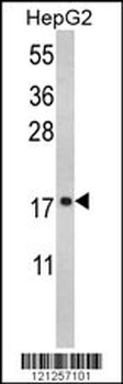 RPS15 Antibody (N-term)