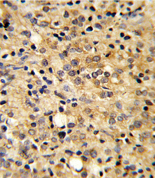 COMP Antibody (Center)