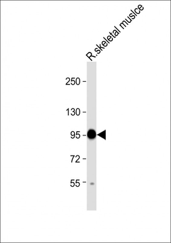 COMP Antibody (Center)