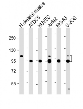 COMP Antibody (Center)