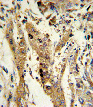 GSTM1 Antibody (C-term)