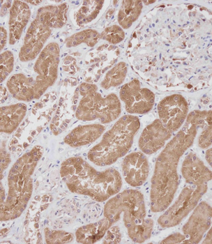 RS18 Antibody (Center)