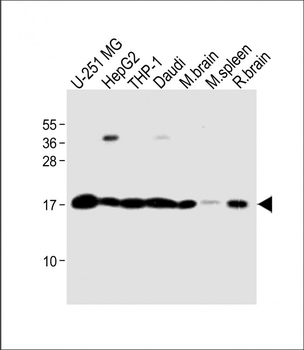RS18 Antibody (Center)