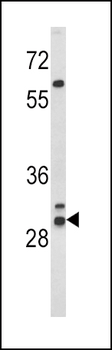 HLA-DRB1 Antibody (N-term)
