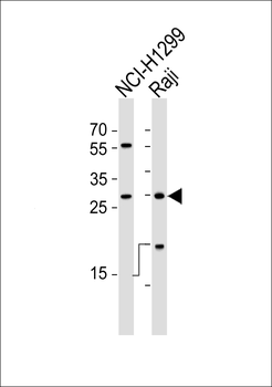 HLA-DRB1 Antibody (N-term)