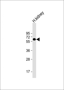 ETFDH Antibody (N-term)