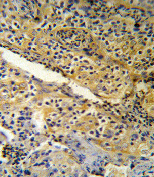SPINK5 Antibody (N-term)
