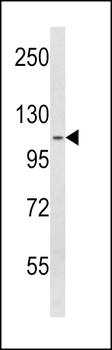 SPINK5 Antibody (N-term)