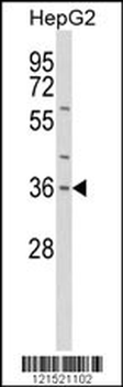 IL1A Antibody (Center)