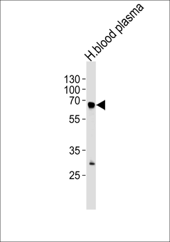 FGA Antibody (N-term)