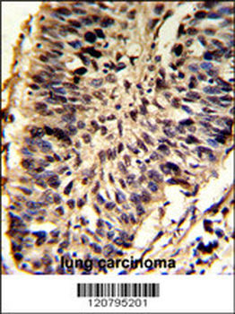 SNRPD2 Antibody (N-term)