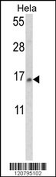 SNRPD2 Antibody (N-term)