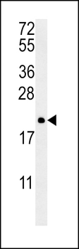 PTP4A2 Antibody (Center)