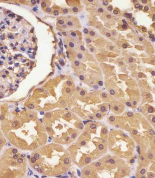 ASS Antibody (Center)