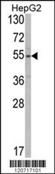 SLC38A3 Antibody (Center)