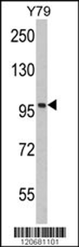 KPNB1 Antibody (N-term)