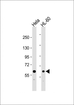 MTM1 Antibody (C-term)