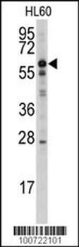 MTM1 Antibody (N-term)