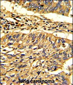 Hsp 60 Antibody (N-term)