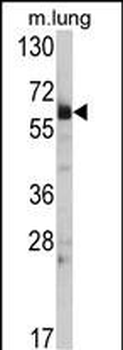 Hsp 60 Antibody (N-term)