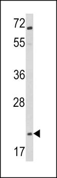 Glucagon Antibody (C-term)