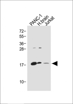 Glucagon Antibody (C-term)