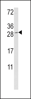GZMM Antibody (Center)