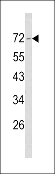 Merlin Antibody (N-term)