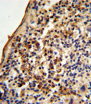 Ku70 Antibody (Center)