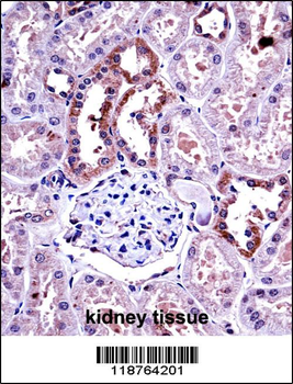 M-CSF Antibody (Center)