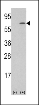 M-CSF Antibody (Center)