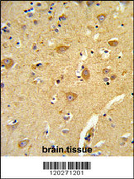 TOMM70A Antibody (N-term)
