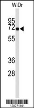TOMM70A Antibody (N-term)