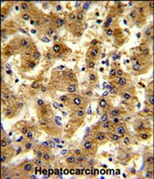 ADH1B Antibody (Center)