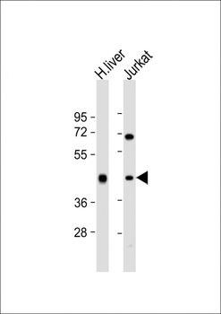ADH1B Antibody (Center)